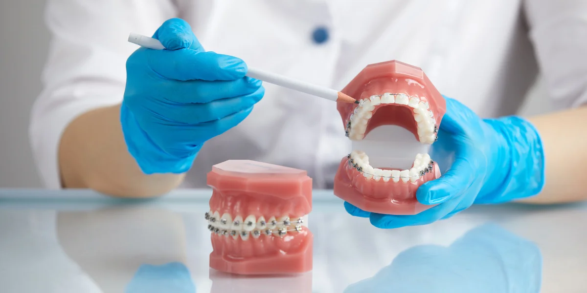 Orthodontist vs. Periodontist